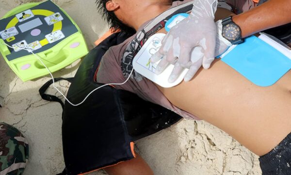 Mesin Defibrillator Teknologi Penyelamat Nyawa Dalam Keadaan Darurat