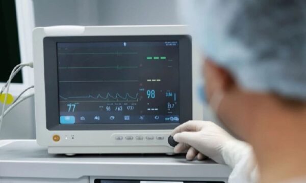 Mesin ECG Electrocardiogram Teknologi Kunci dalam Diagnosa Jantung