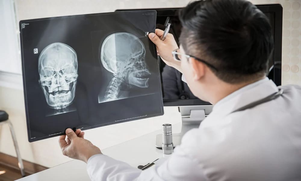 Mesin X Ray Teknologi Penunjang Diagnosa Medis